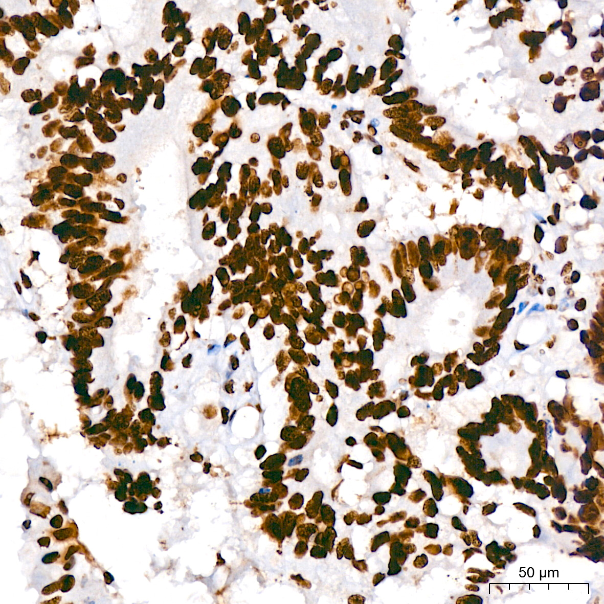 hnRNP U Rabbit monoclonal antibody