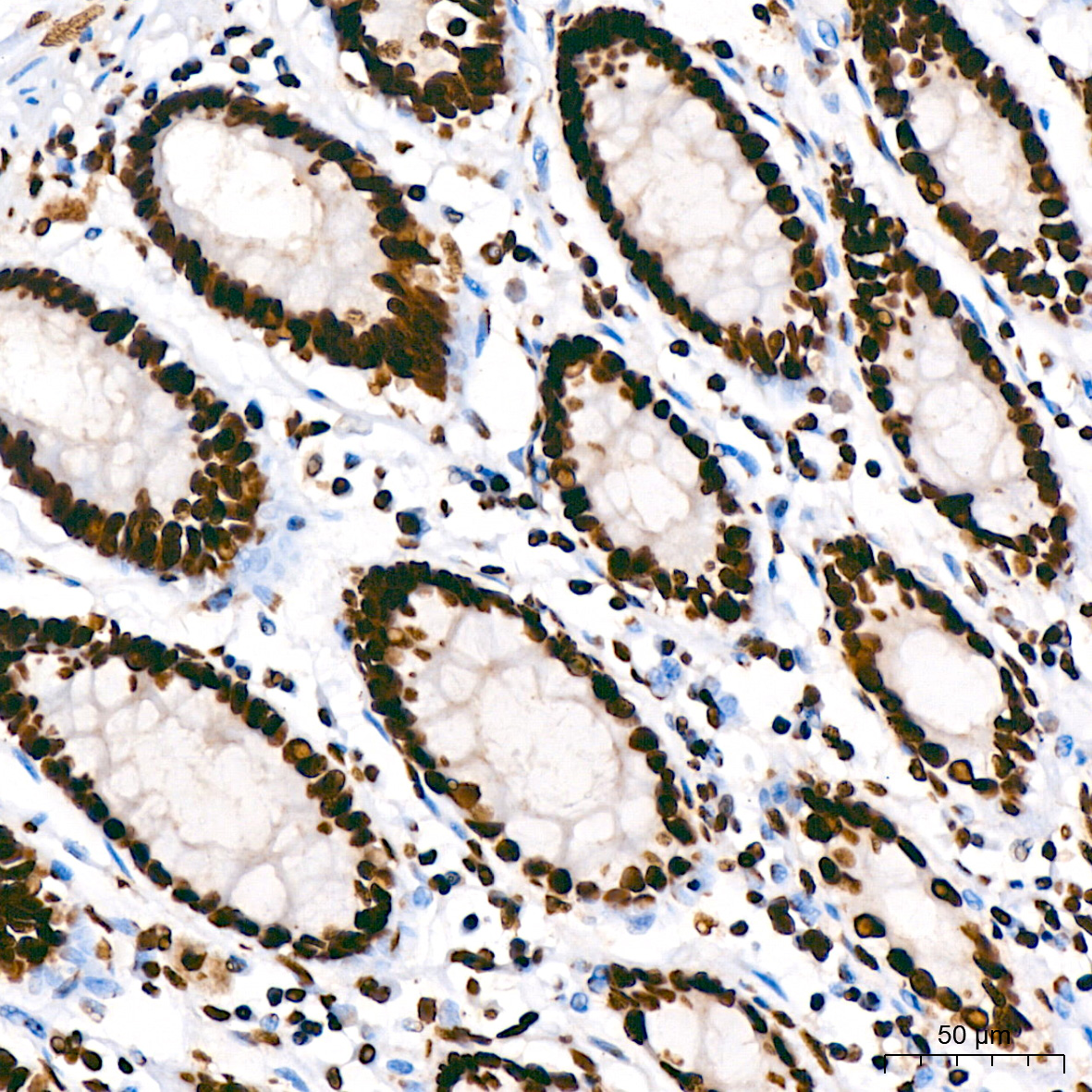 hnRNP U Rabbit monoclonal antibody