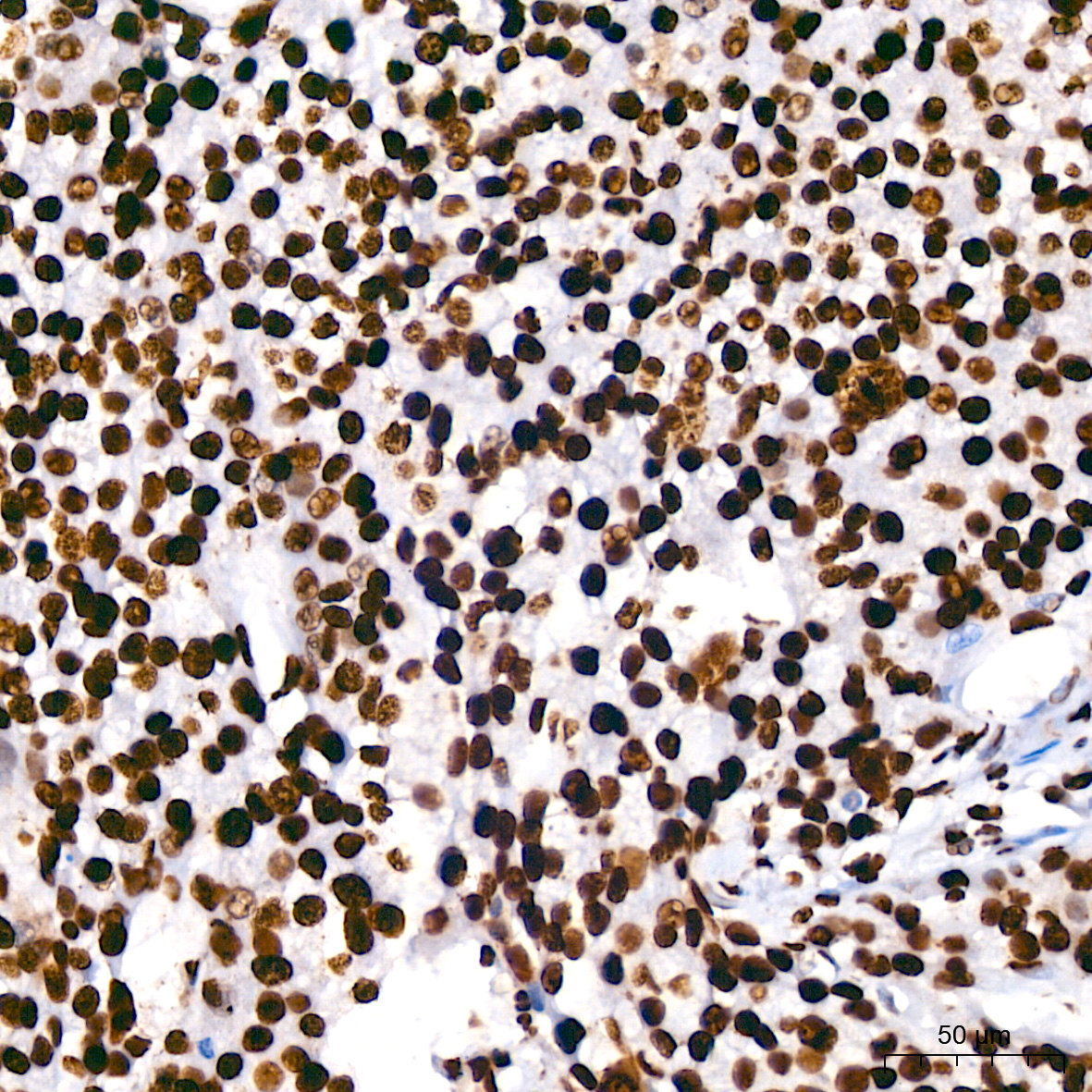 hnRNP U Rabbit monoclonal antibody