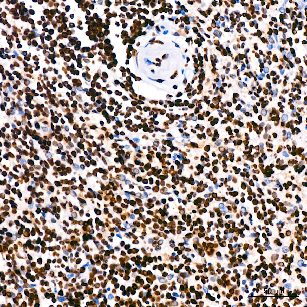 hnRNP U Rabbit monoclonal antibody