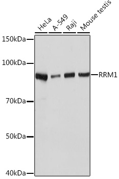 RRM1 Rabbit monoclonal antibody