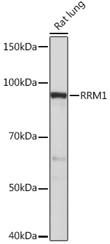 RRM1 Rabbit monoclonal antibody