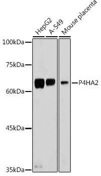 P4HA2 Rabbit polyclonal antibody