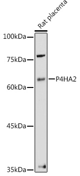 P4HA2 Rabbit polyclonal antibody