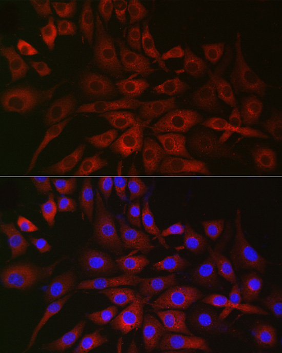 P4HA2 Rabbit polyclonal antibody