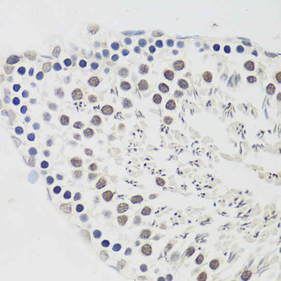Cyclin E2 Rabbit polyclonal antibody