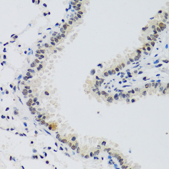Cyclin E2 Rabbit polyclonal antibody