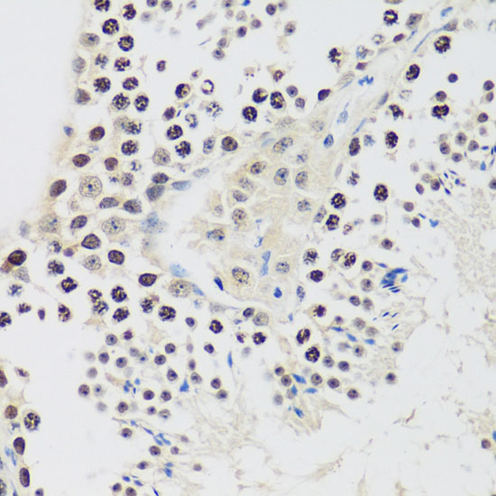 Cyclin E2 Rabbit polyclonal antibody