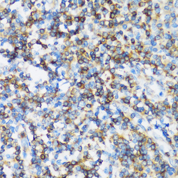 [KO Validated] ARHGEF1 Rabbit polyclonal antibody