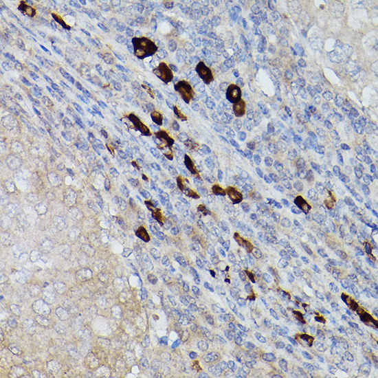 UBE2L6 Rabbit polyclonal antibody