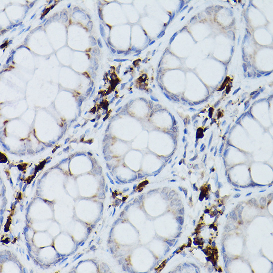 UBE2L6 Rabbit polyclonal antibody