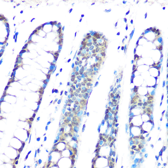 HP1 gamma/CBX3 Rabbit monoclonal antibody