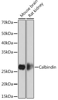 Calbindin Rabbit monoclonal antibody