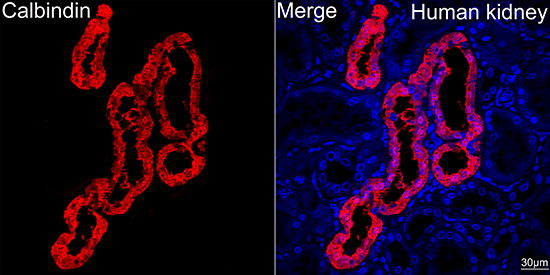 Calbindin Rabbit monoclonal antibody