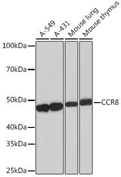CCR8 Rabbit monoclonal antibody