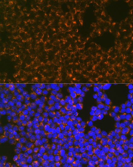 CCR8 Rabbit monoclonal antibody