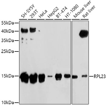 RPL23 Rabbit polyclonal antibody