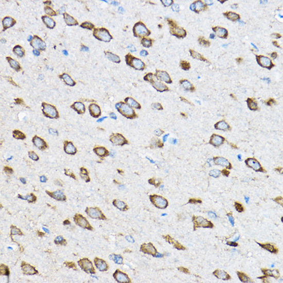 RPL23 Rabbit polyclonal antibody