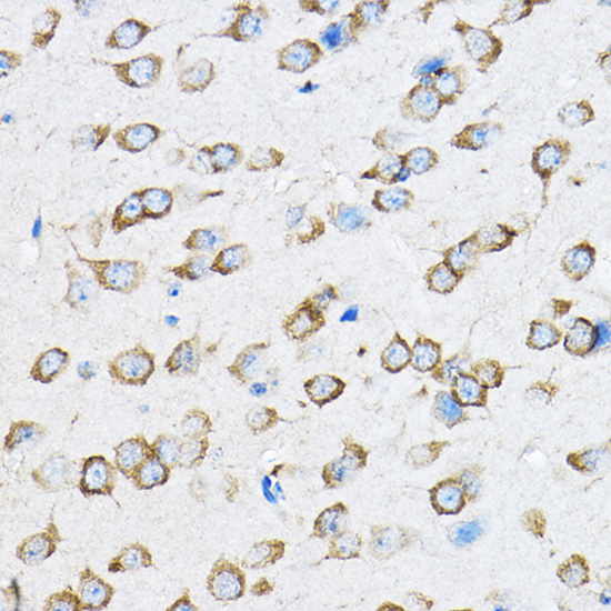 RPL23 Rabbit polyclonal antibody