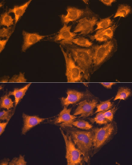 RPL23 Rabbit polyclonal antibody