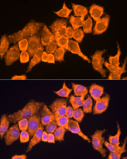 RPL23 Rabbit polyclonal antibody