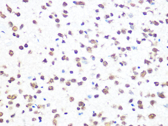 THOC4/ALYREF Rabbit monoclonal antibody