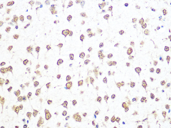 THOC4/ALYREF Rabbit monoclonal antibody