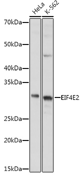 EIF4E2 Rabbit polyclonal antibody