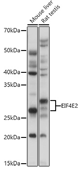 EIF4E2 Rabbit polyclonal antibody