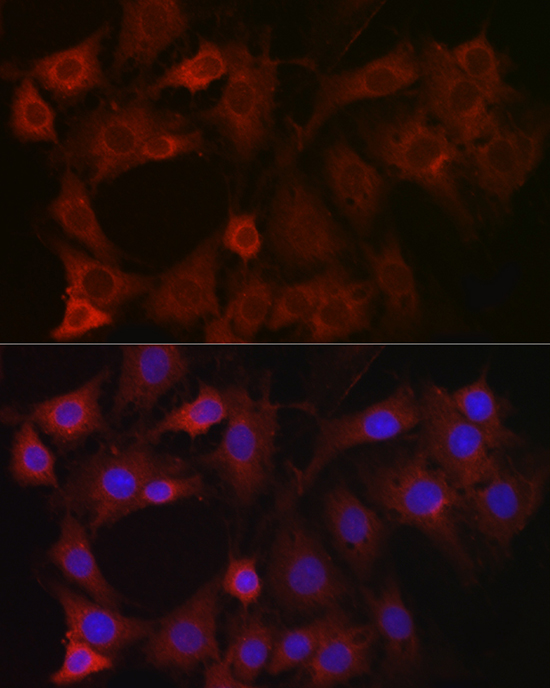EIF4E2 Rabbit polyclonal antibody