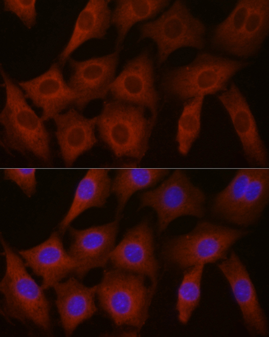 EIF4E2 Rabbit polyclonal antibody