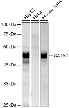 GATA4 Rabbit monoclonal antibody