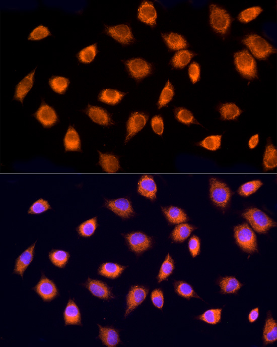 RPH3AL Rabbit polyclonal antibody