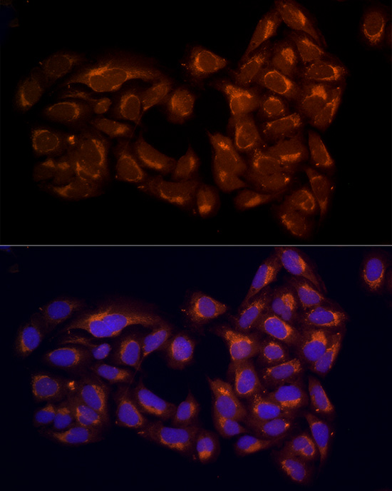 RPH3AL Rabbit polyclonal antibody