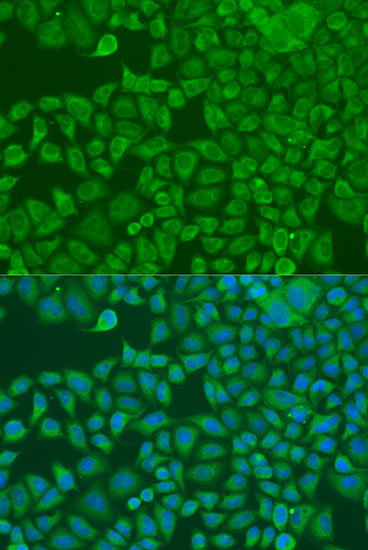 ABclonal:Immunofluorescence - FXR2 Rabbit pAb (A4313)}