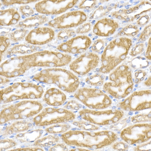 PDIA4 Rabbit polyclonal antibody