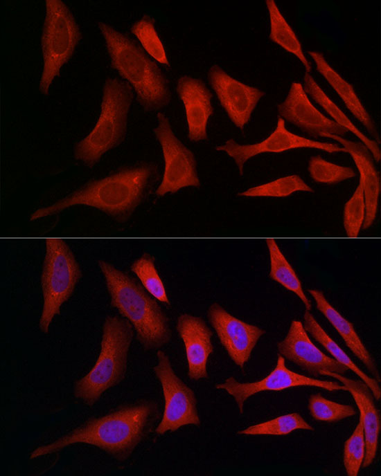PDIA4 Rabbit polyclonal antibody