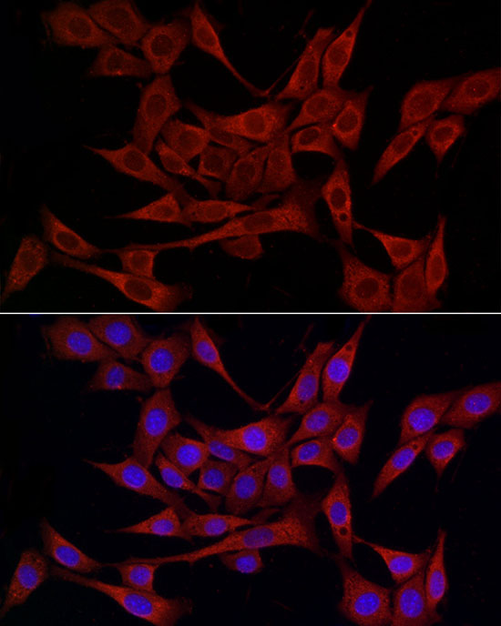 PDIA4 Rabbit polyclonal antibody