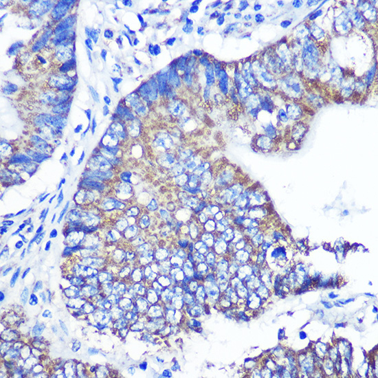 ABCG1 Rabbit polyclonal antibody