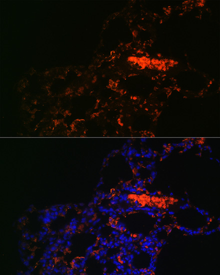 ABCG1 Rabbit polyclonal antibody