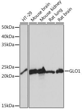 GLO1 Rabbit mAb