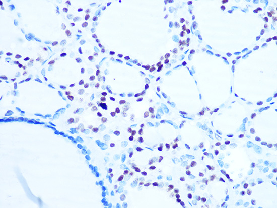 Histone H1.0 Rabbit monoclonal antibody