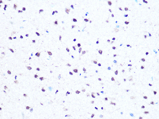 HMGA1 Rabbit monoclonal antibody
