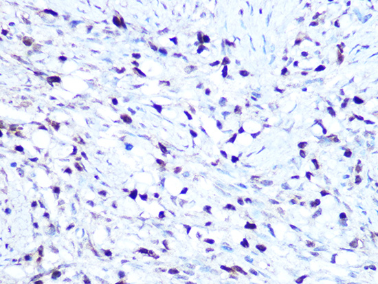 HMGA1 Rabbit monoclonal antibody