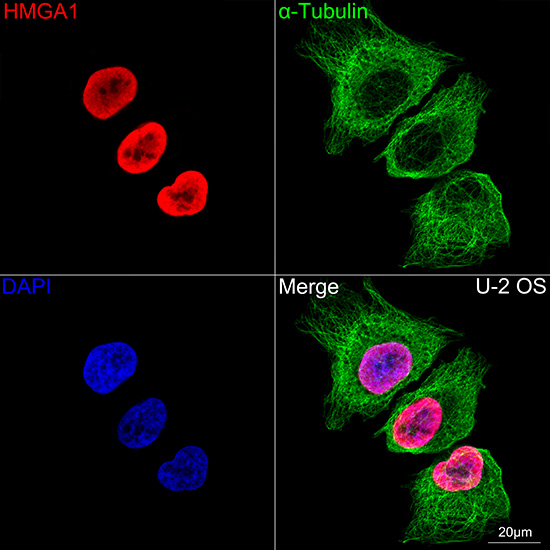HMGA1 Rabbit monoclonal antibody