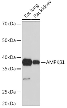 AMPKB Beta1 Rabbit monoclonal antibody