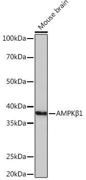 AMPKB Beta1 Rabbit monoclonal antibody