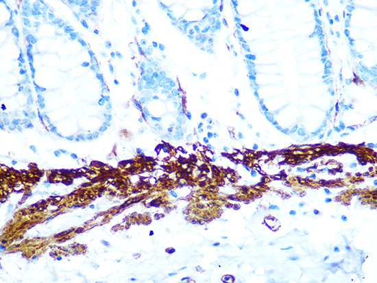 AMPKB Beta1 Rabbit monoclonal antibody