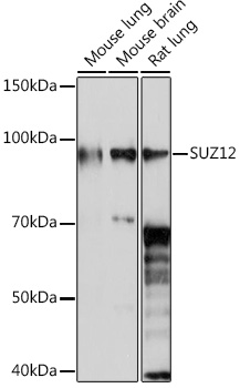 SUZ12 Rabbit monoclonal antibody