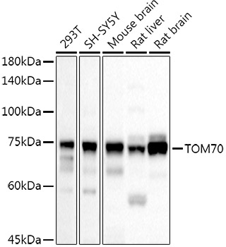TOM70 Rabbit polyclonal antibody